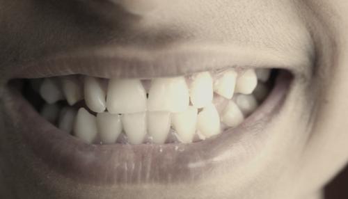 Sonrisa en primer plano con tono amarillento (versión «antes» de la demo)